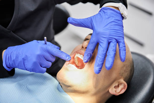 Best Broken or Cracked Tooth Emergency Dentist in North Madison, OH